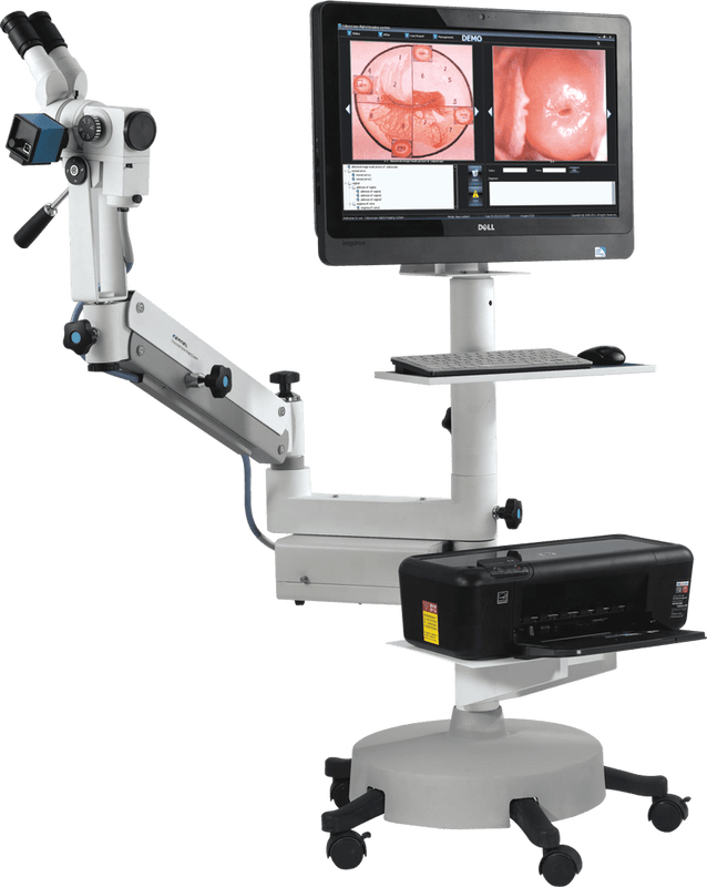 Digital Colposcope Imaging System with 30× Optical Magnification image 1