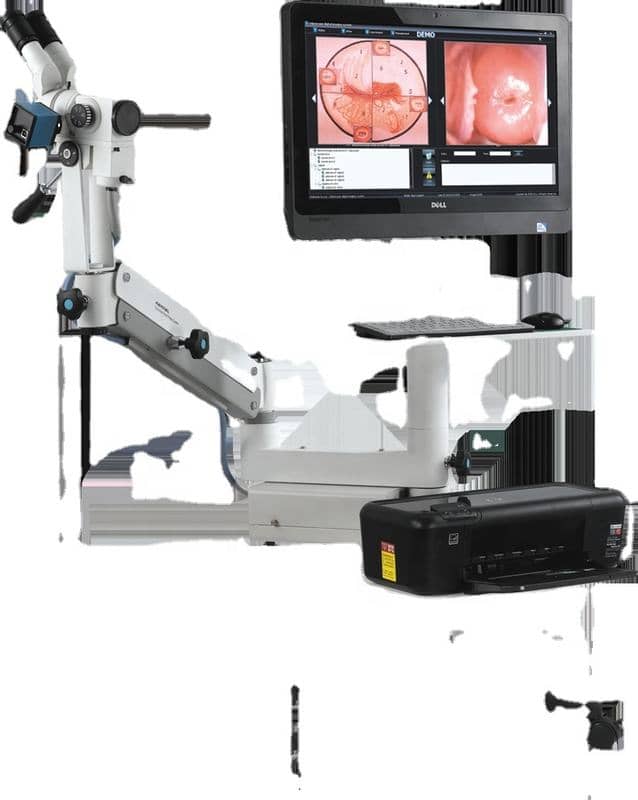 Digital Colposcope Imaging System with 30× Optical Magnification image 2