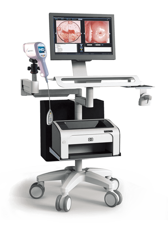 Digital Colposcope Imaging System with 30× Optical Magnification image 3